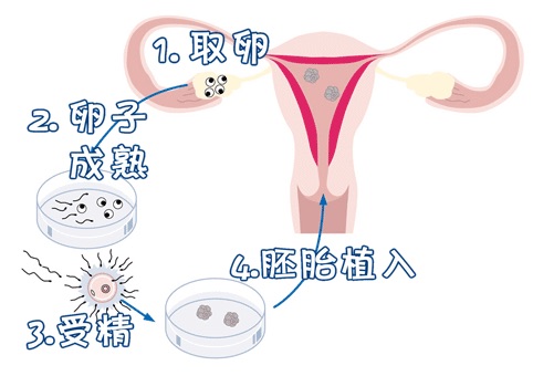 林教授
